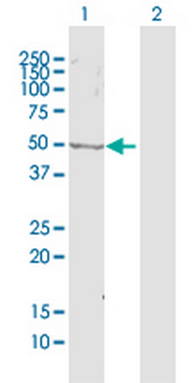 ZWILCH Antibody in Western Blot (WB)