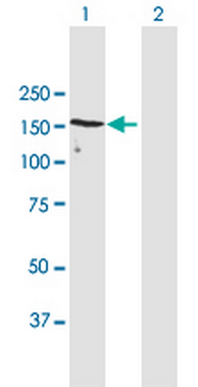 UACA Antibody in Western Blot (WB)