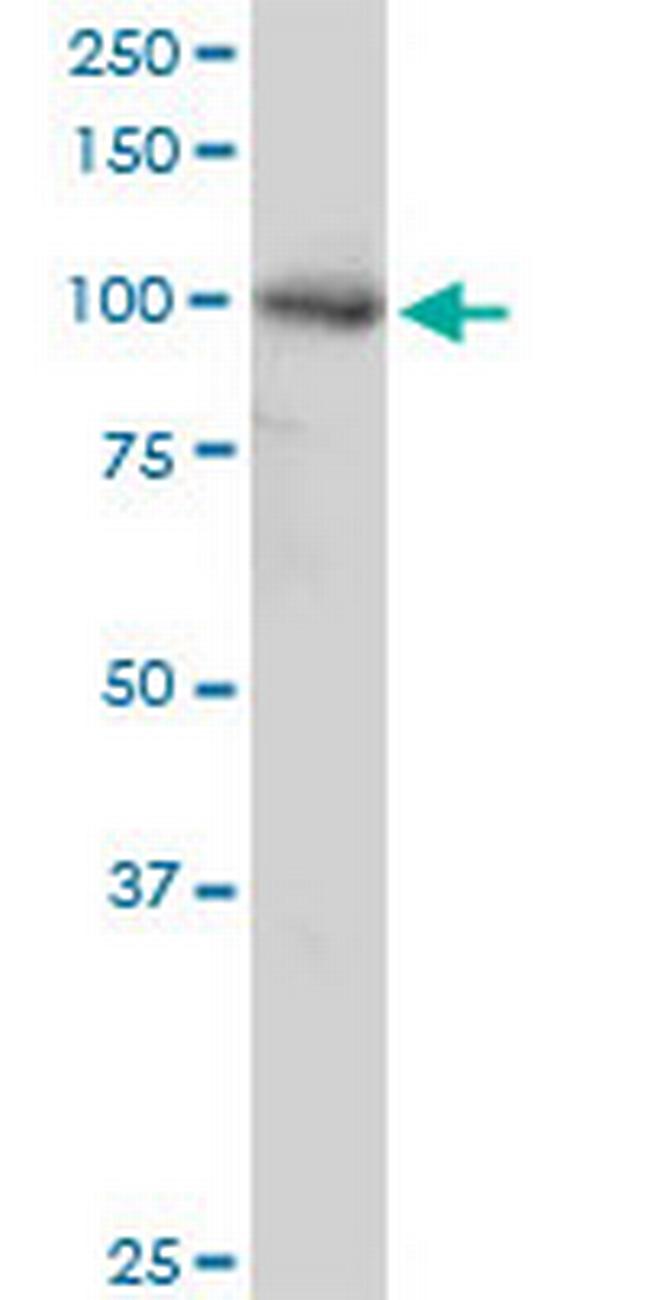 AGGF1 Antibody in Western Blot (WB)