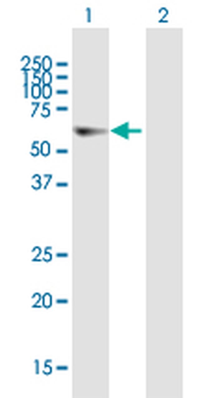 ELP3 Antibody in Western Blot (WB)