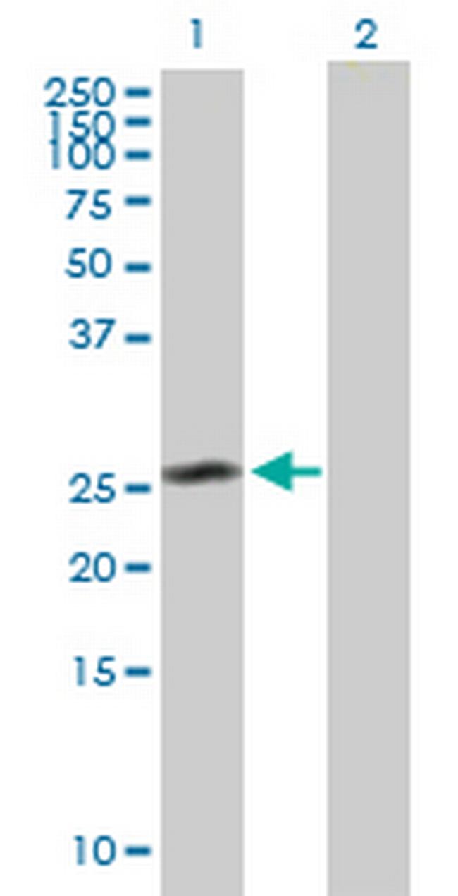 CEP27 Antibody in Western Blot (WB)