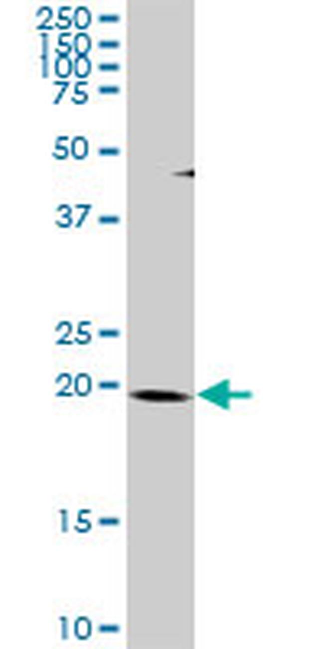 THAP1 Antibody in Western Blot (WB)