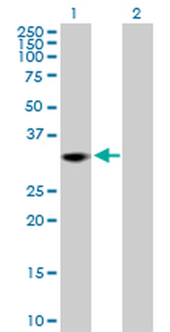 THAP1 Antibody in Western Blot (WB)