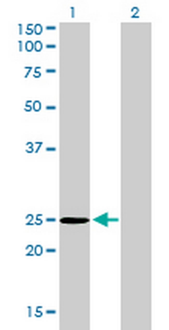 THAP1 Antibody in Western Blot (WB)