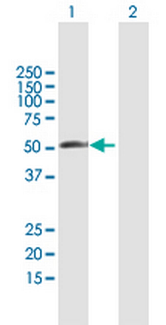 RBM23 Antibody in Western Blot (WB)