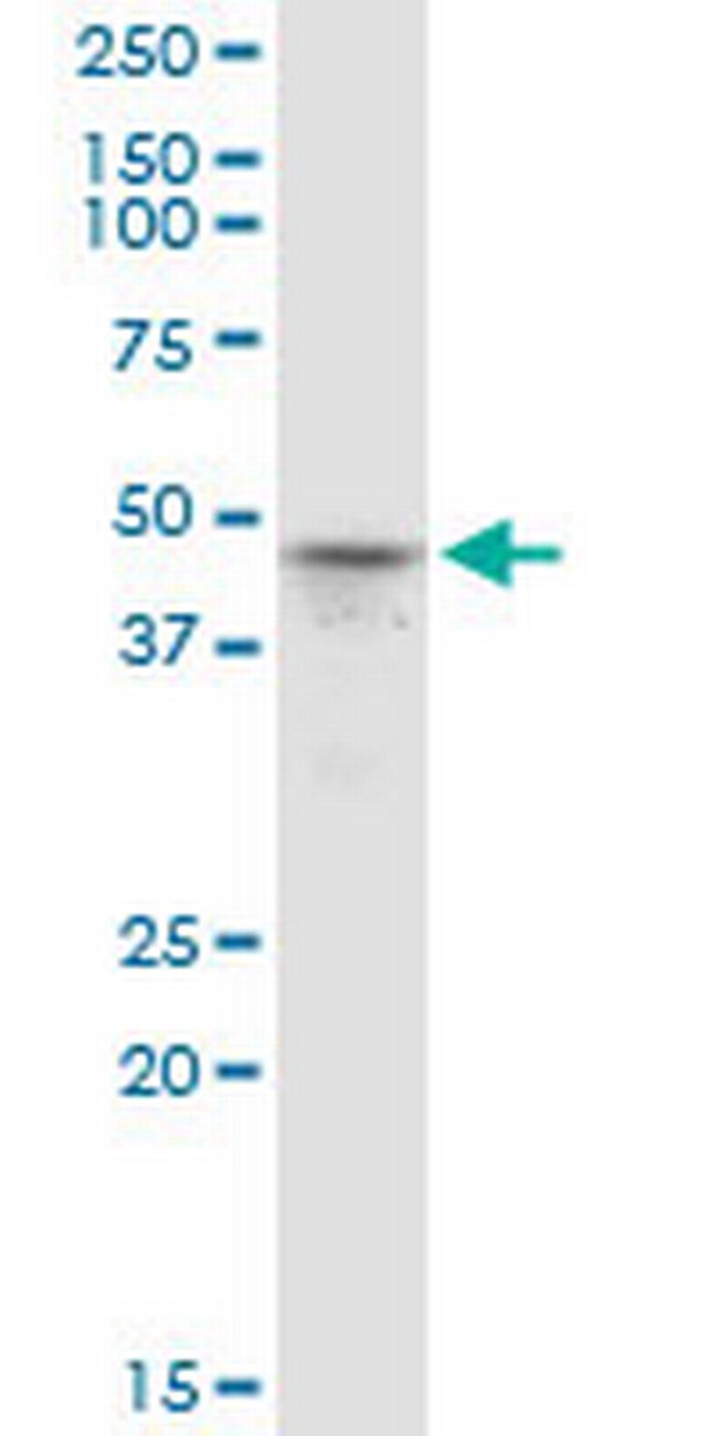 PRMT6 Antibody in Western Blot (WB)