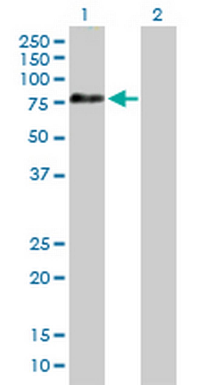 APPL2 Antibody in Western Blot (WB)