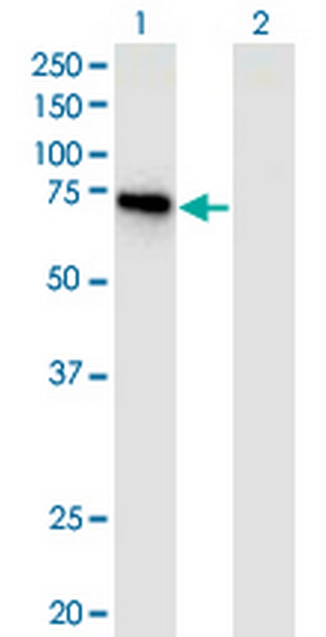 APPL2 Antibody in Western Blot (WB)