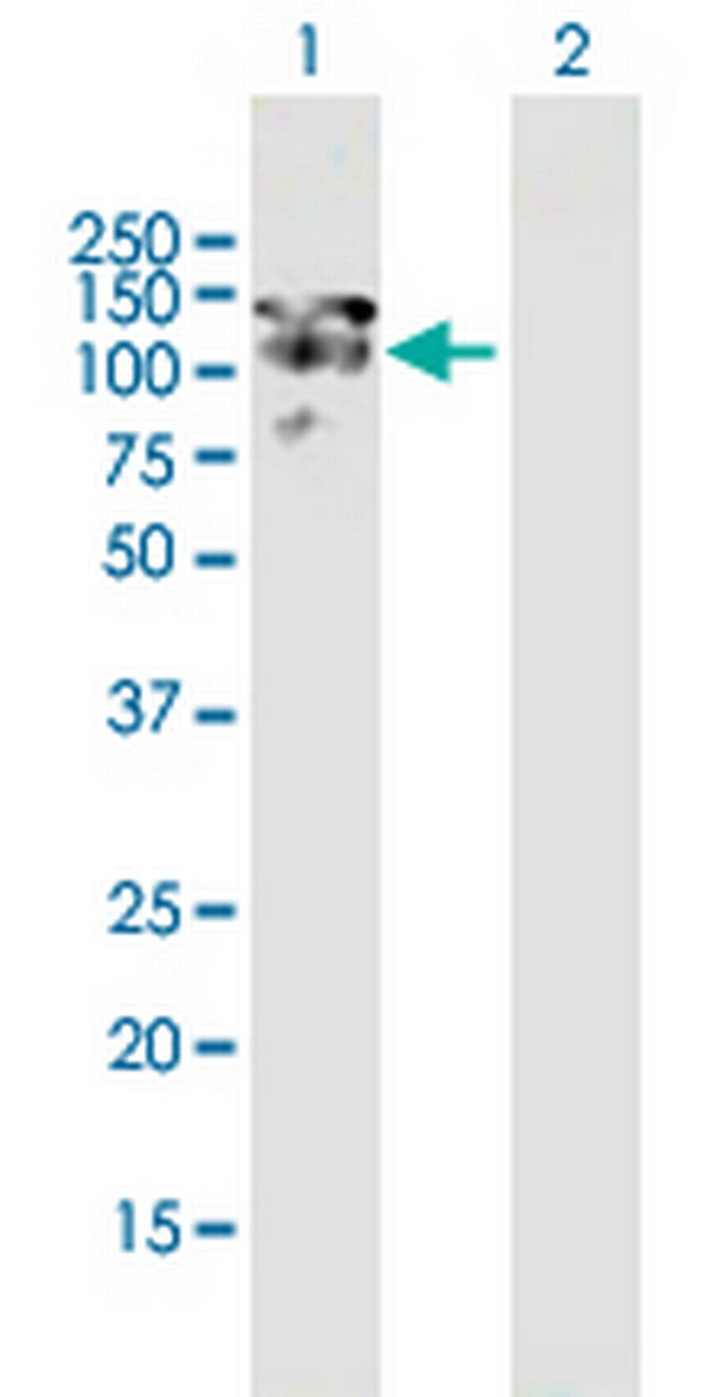 MAP1S Antibody in Western Blot (WB)