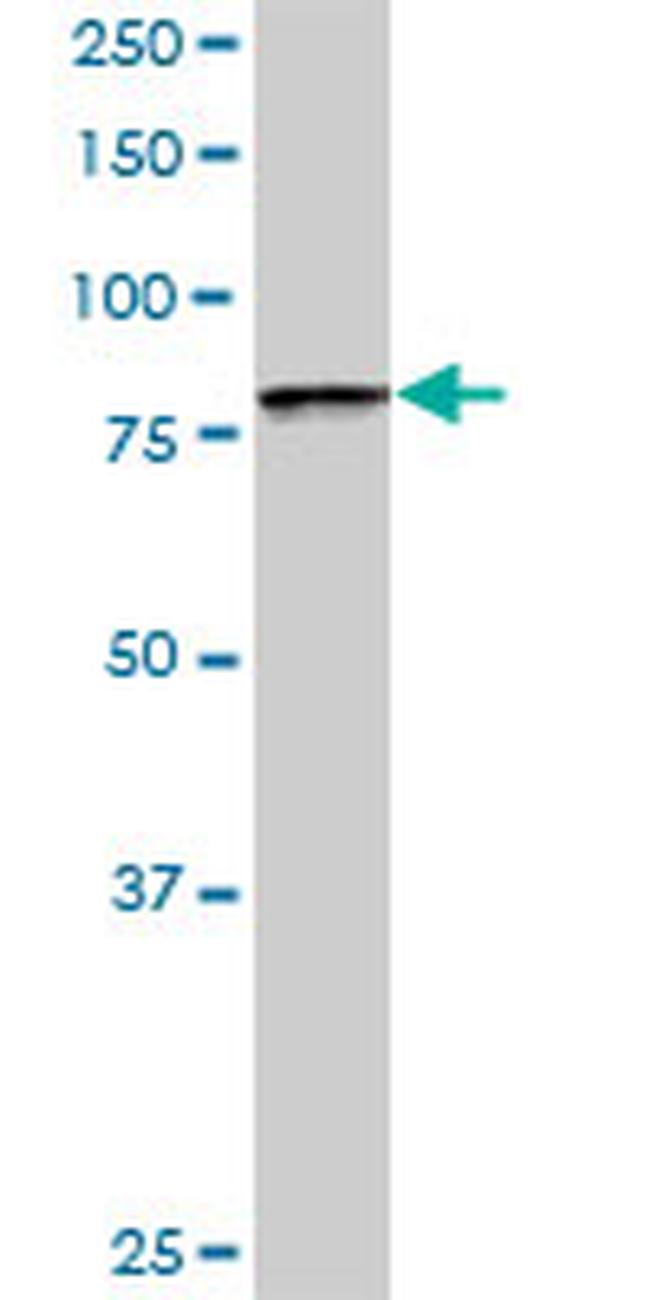 BBS7 Antibody in Western Blot (WB)