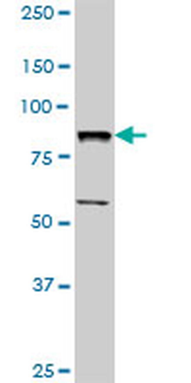 BBS7 Antibody in Western Blot (WB)