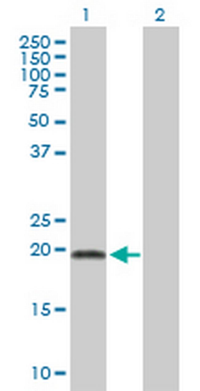 ADI1 Antibody in Western Blot (WB)