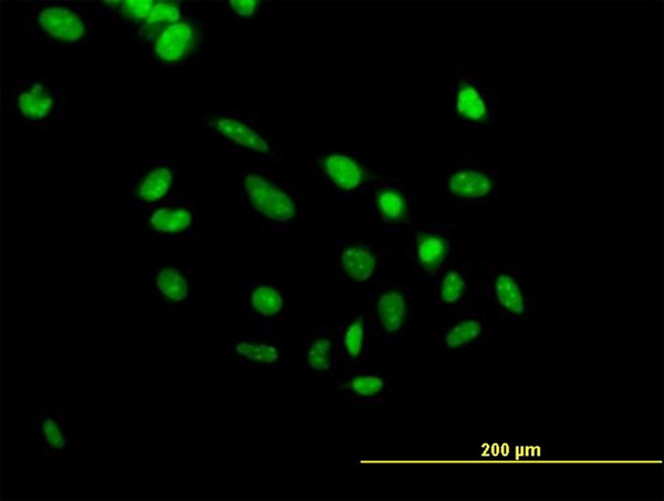 PHF10 Antibody in Immunocytochemistry (ICC/IF)