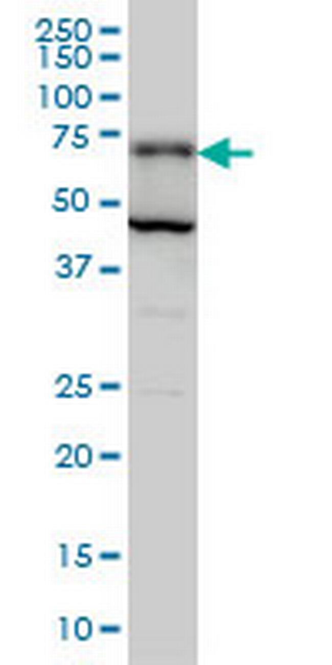 PGM2 Antibody in Western Blot (WB)