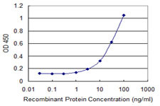 FLJ10986 Antibody in ELISA (ELISA)