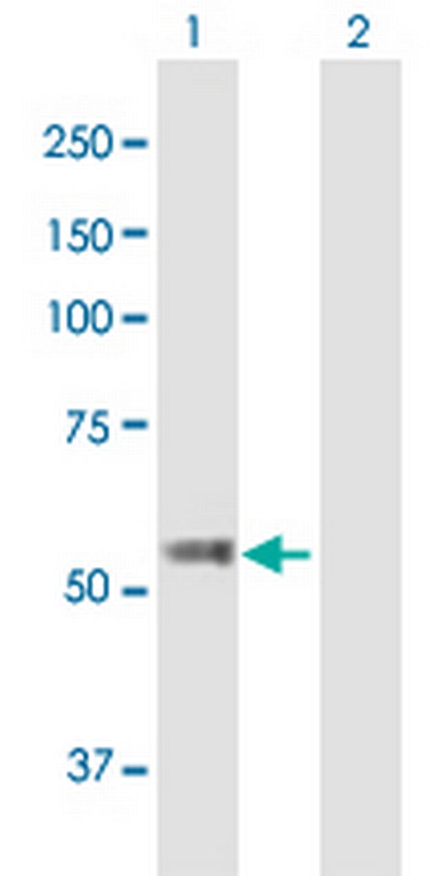 TBC1D19 Antibody in Western Blot (WB)