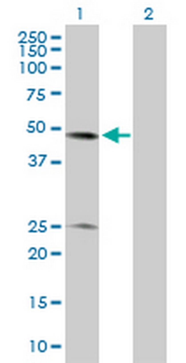 BXDC2 Antibody in Western Blot (WB)