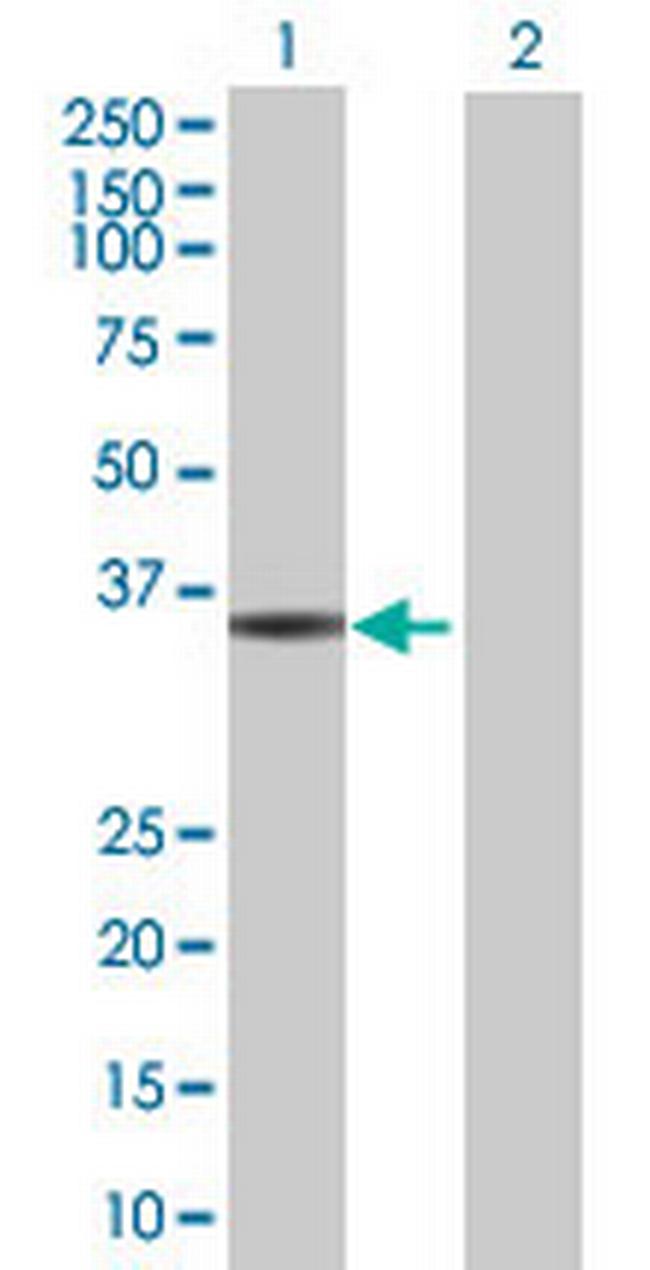 C10orf59 Antibody in Western Blot (WB)