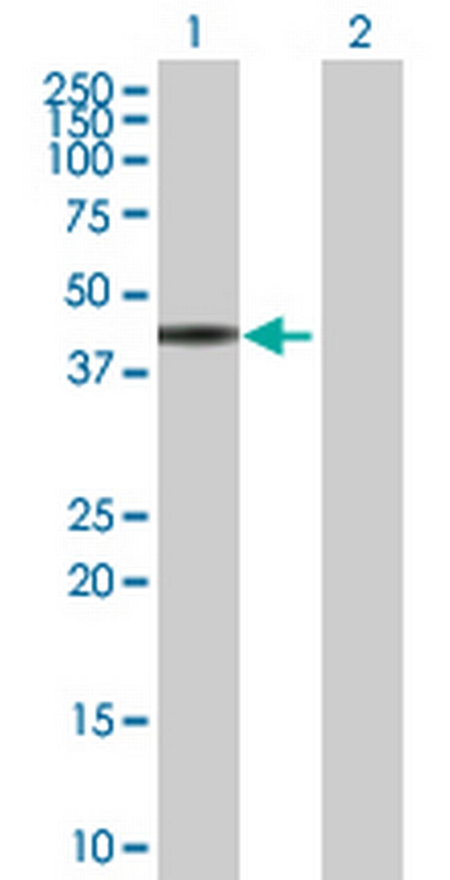 ZNF331 Antibody in Western Blot (WB)