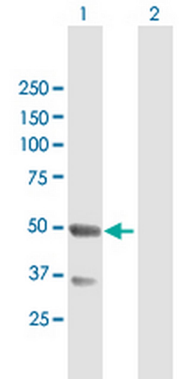 TNFRSF19 Antibody in Western Blot (WB)