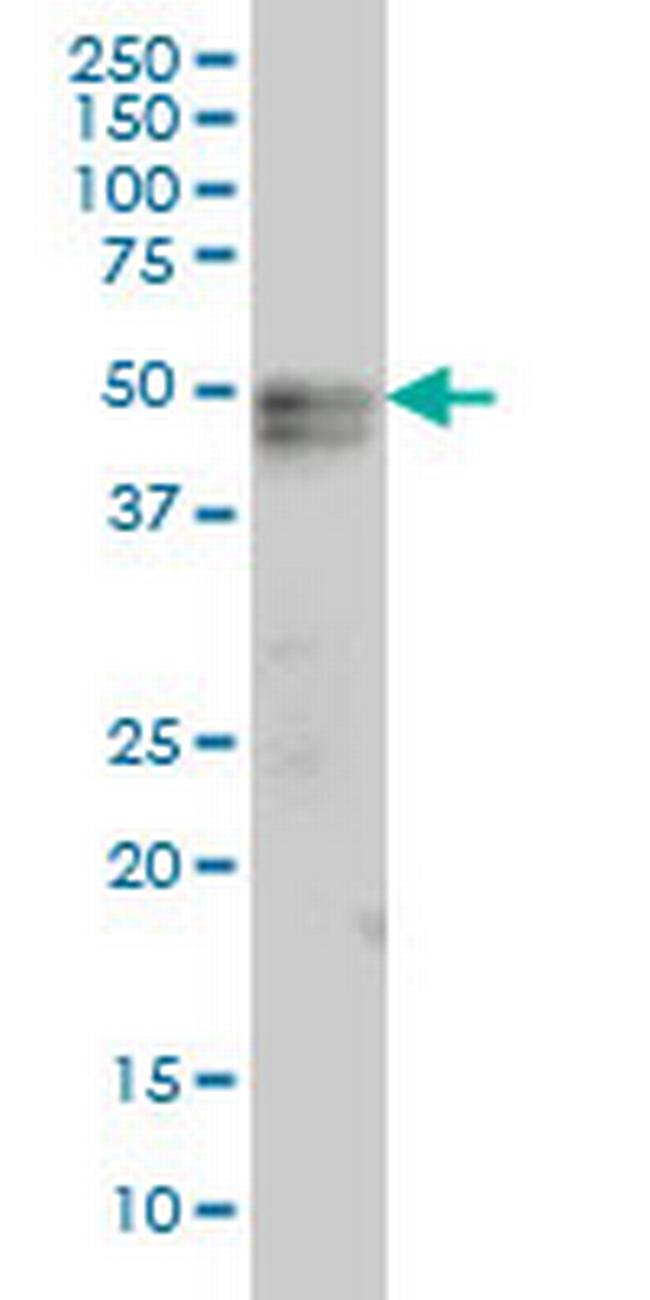 TNFRSF19 Antibody in Western Blot (WB)