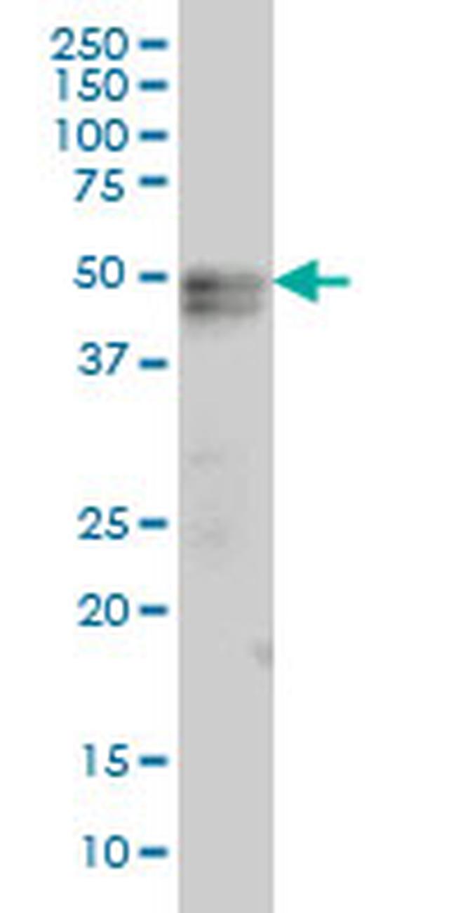 TNFRSF19 Antibody in Western Blot (WB)