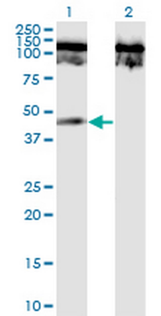 TNFRSF19 Antibody in Western Blot (WB)