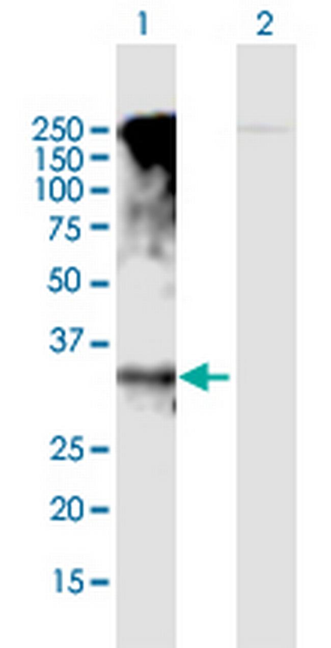 GPRC5D Antibody in Western Blot (WB)