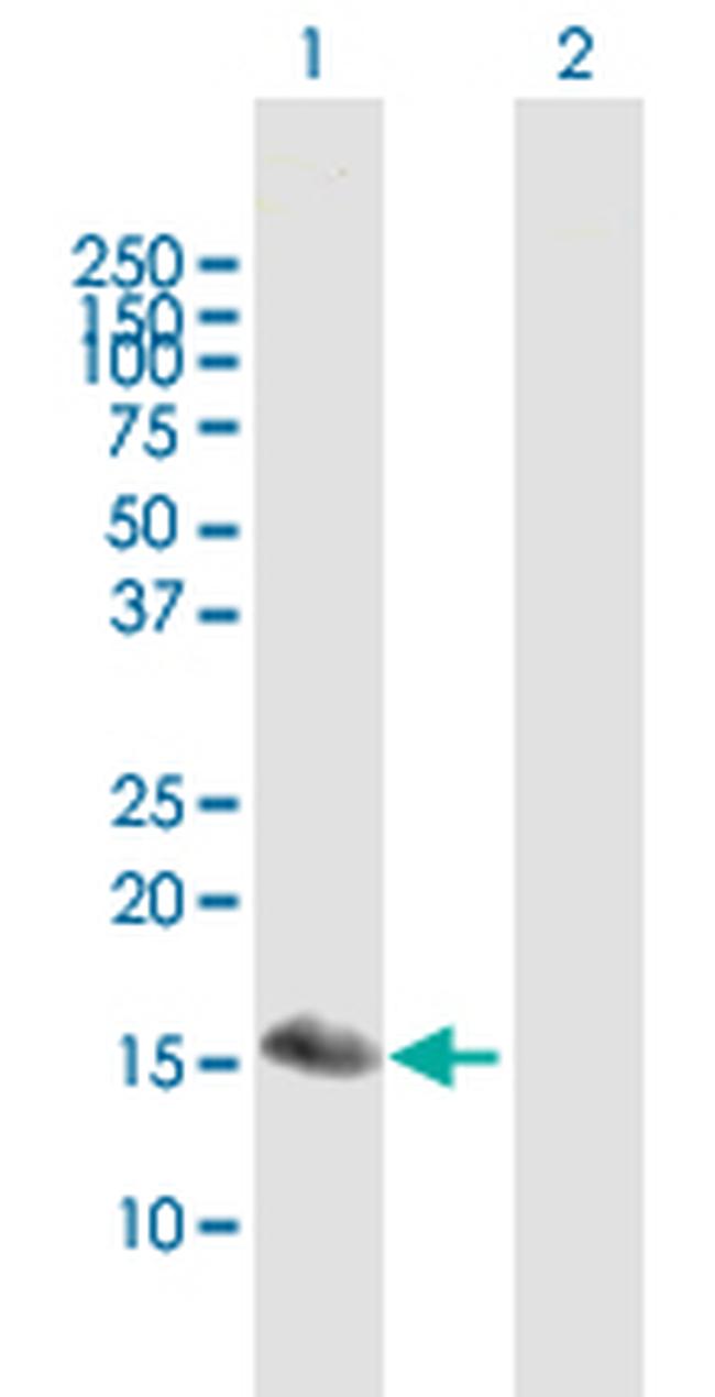 SNFT Antibody in Western Blot (WB)