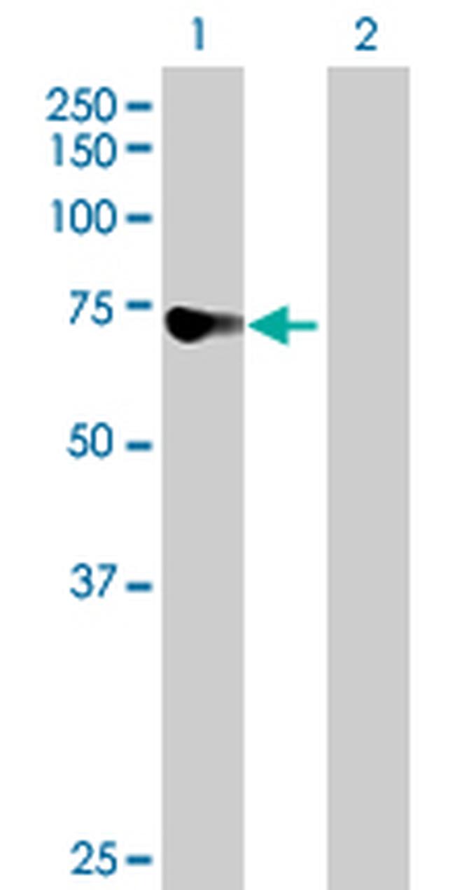 DDX43 Antibody in Western Blot (WB)