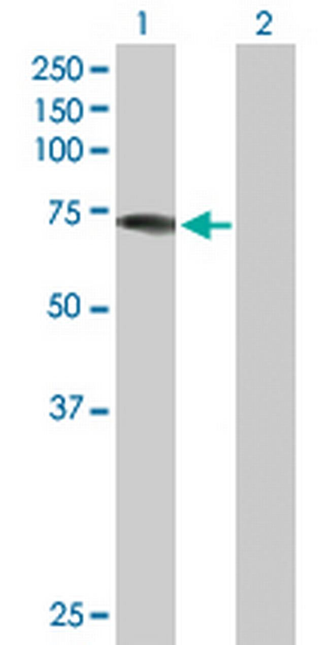 DDX43 Antibody in Western Blot (WB)