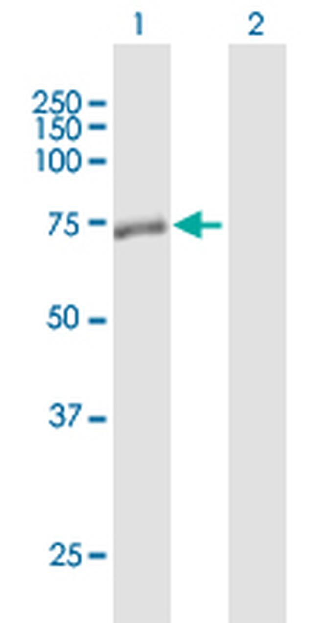 SMPD3 Antibody in Western Blot (WB)