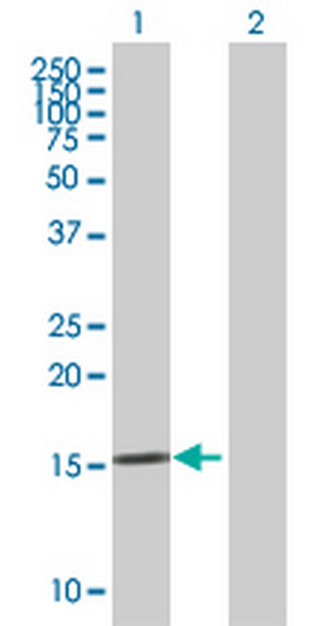 KLK15 Antibody in Western Blot (WB)