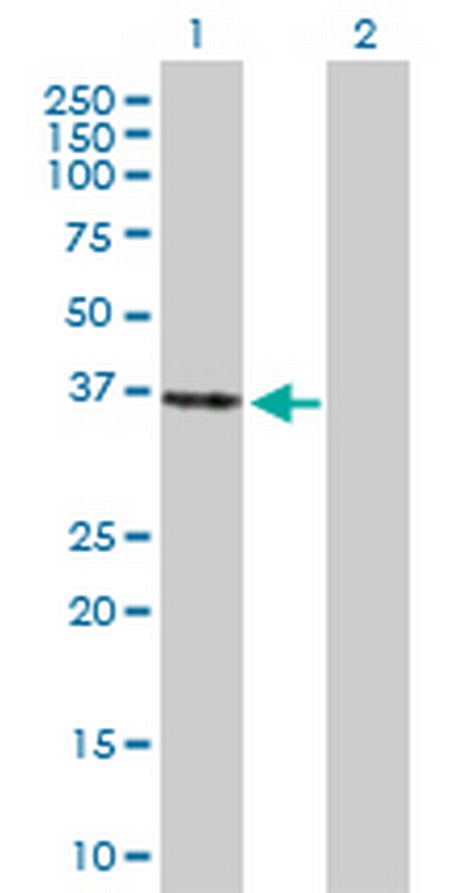 PEX26 Antibody in Western Blot (WB)