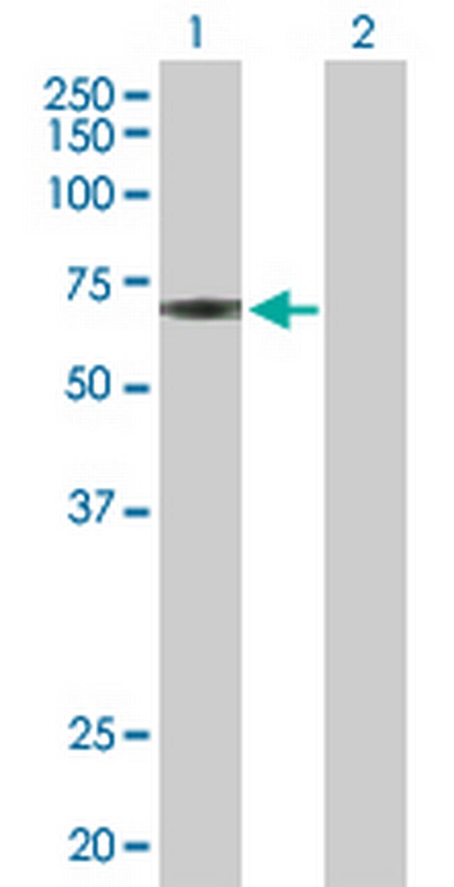 JMJD2D Antibody in Western Blot (WB)