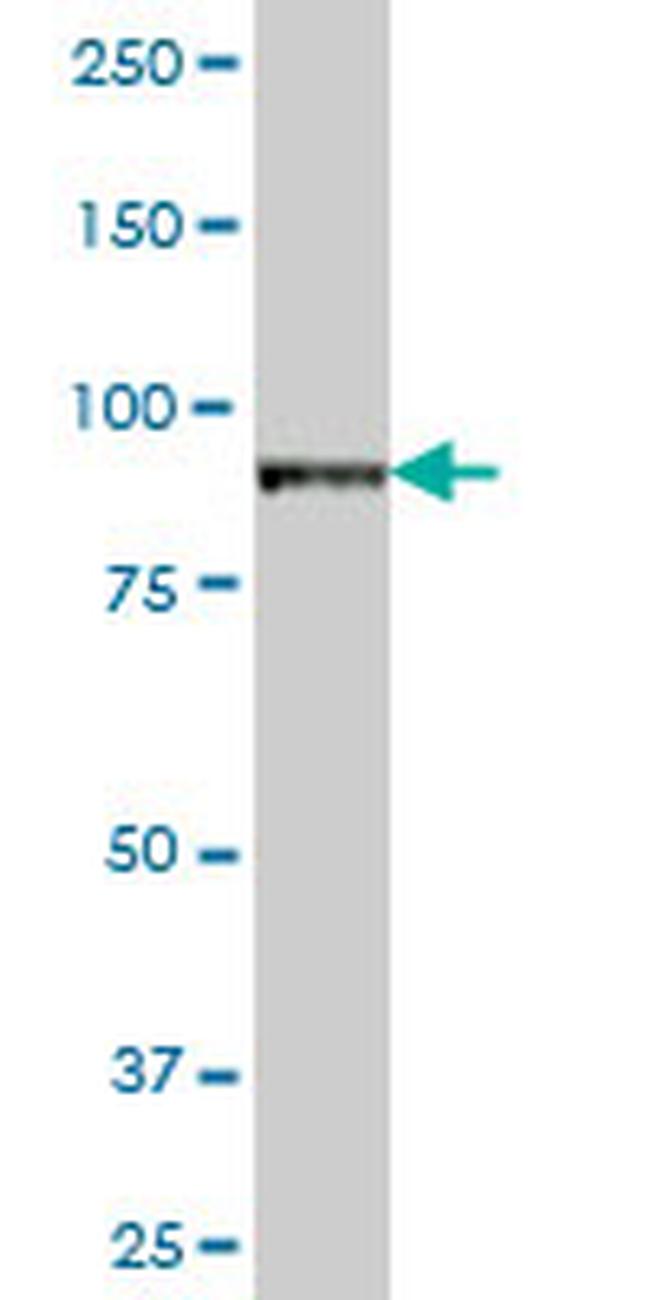 VAC14 Antibody in Western Blot (WB)