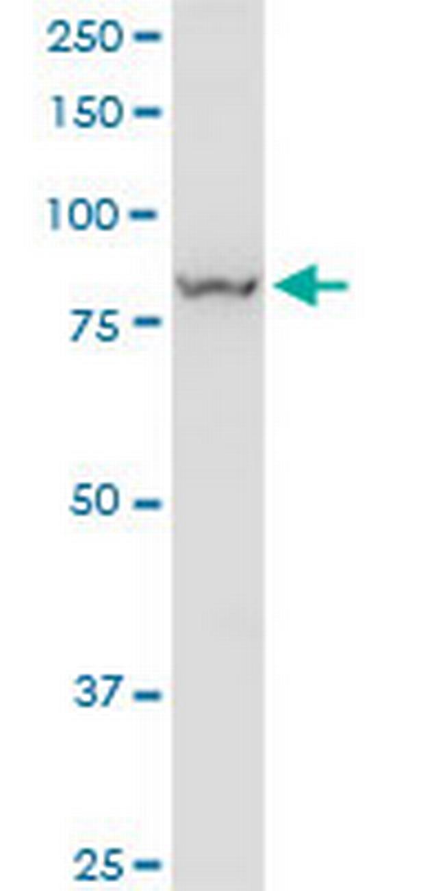 VPS35 Antibody in Western Blot (WB)