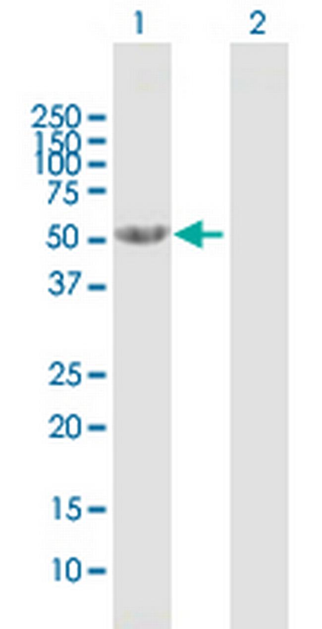 CNDP2 Antibody in Western Blot (WB)