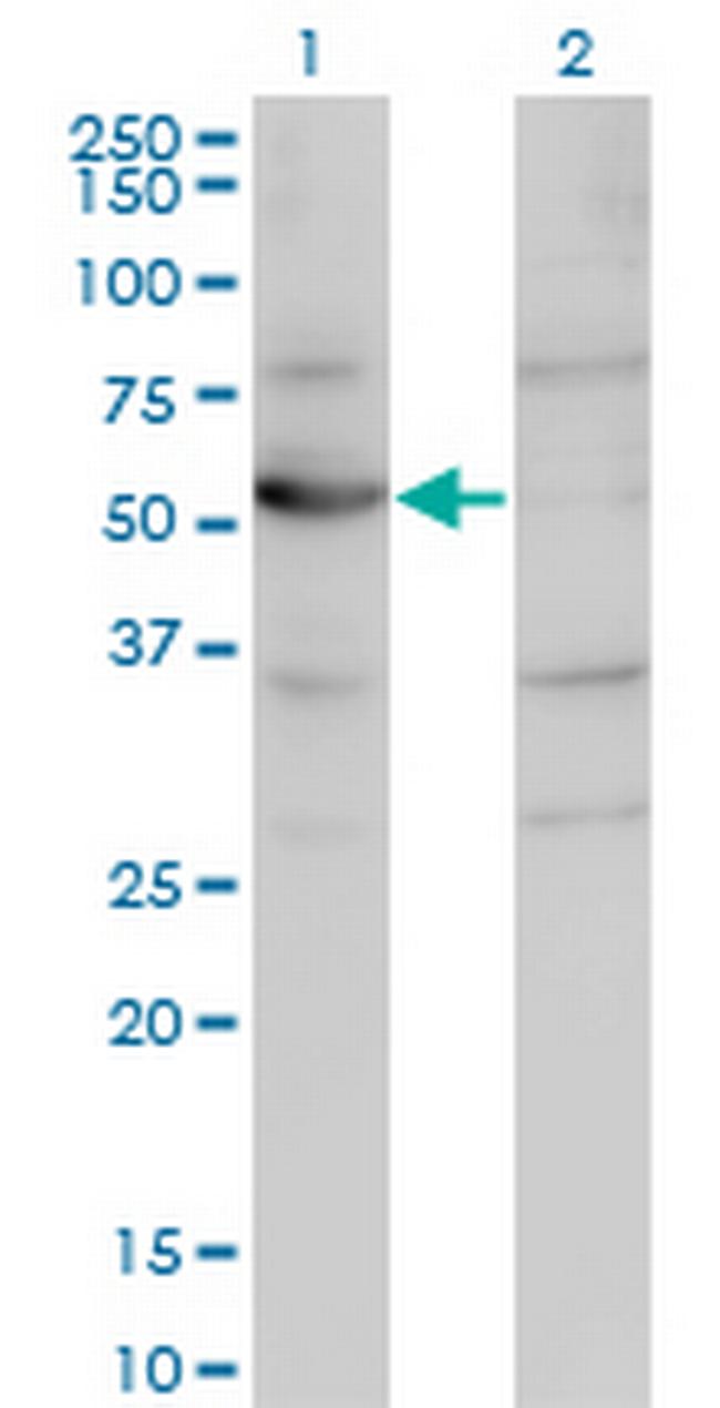 CNDP2 Antibody in Western Blot (WB)