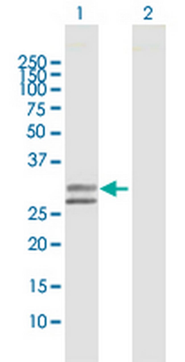 UGCGL2 Antibody in Western Blot (WB)