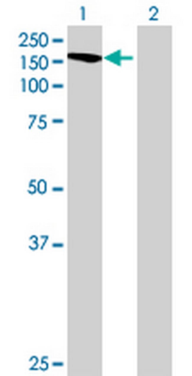 TTC17 Antibody in Western Blot (WB)