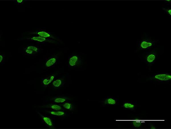 TDP1 Antibody in Immunocytochemistry (ICC/IF)