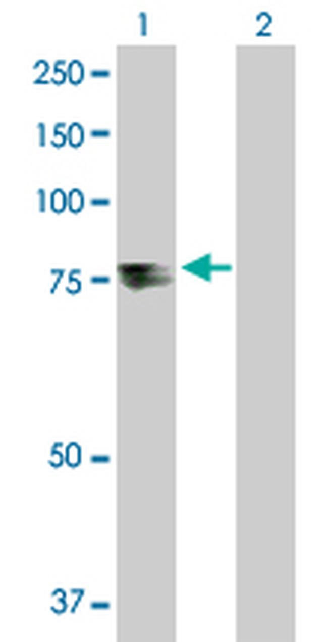 TDP1 Antibody in Western Blot (WB)