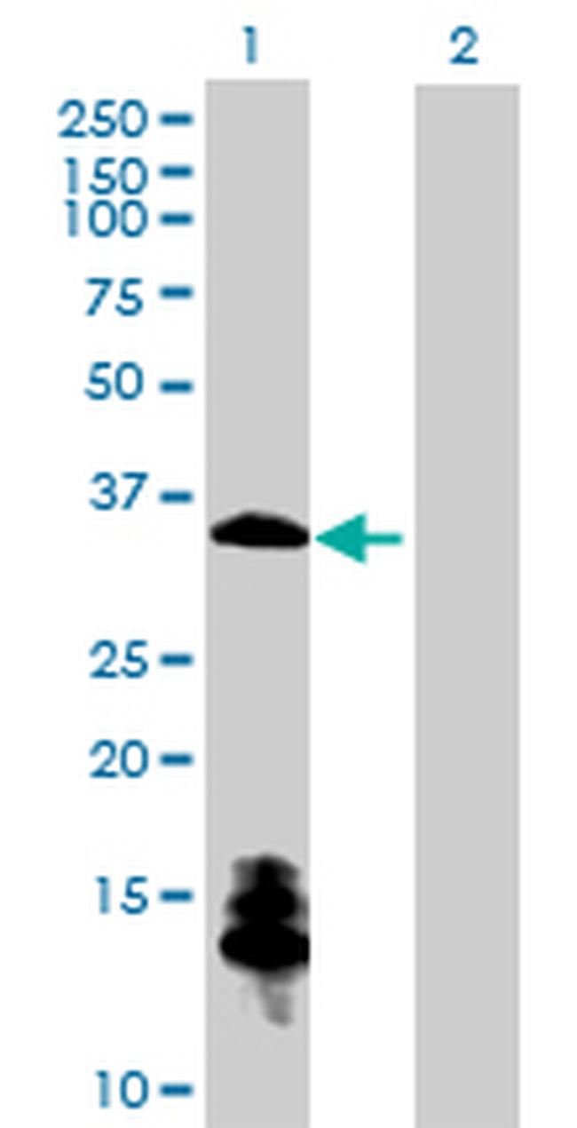 CHGN Antibody in Western Blot (WB)