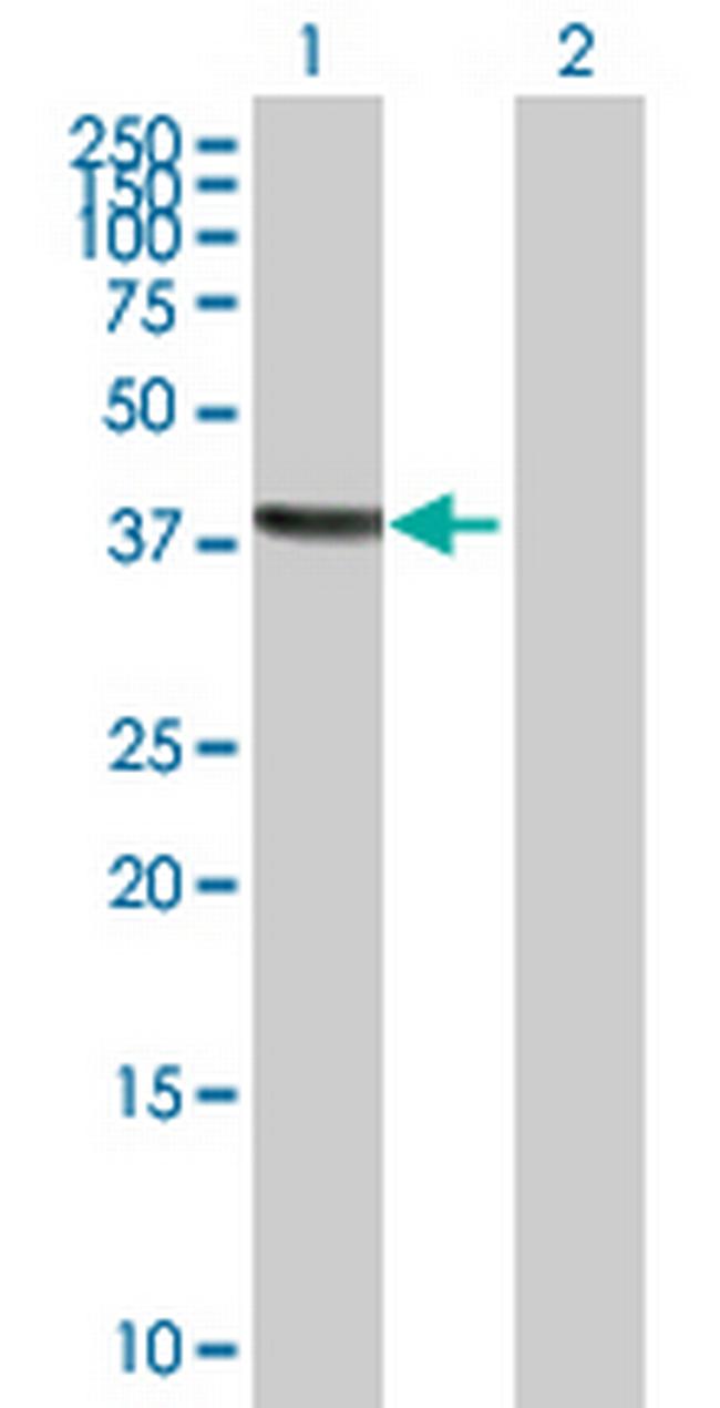 TSNAXIP1 Antibody in Western Blot (WB)