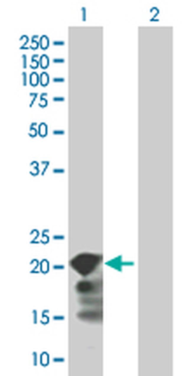 SELS Antibody in Western Blot (WB)