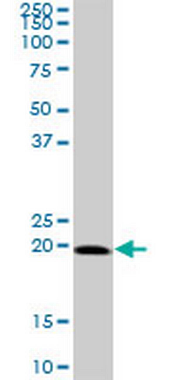 SELS Antibody in Western Blot (WB)