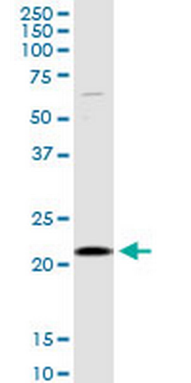 SELS Antibody in Western Blot (WB)