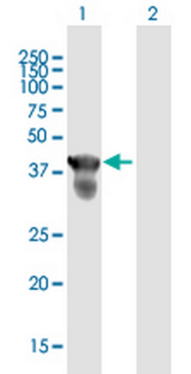 CENPJ Antibody in Western Blot (WB)