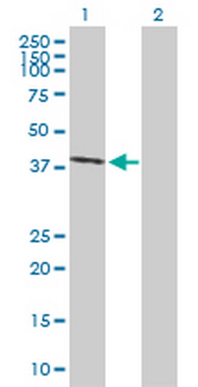 EAF2 Antibody in Western Blot (WB)